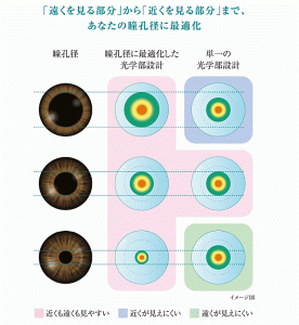 アキュビューオアシスマルチフォーカルの瞳孔径